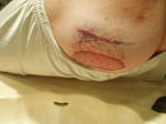 Click image for larger version

Name:	accident 009.jpg
Views:	76
Size:	27.5 KB
ID:	196317