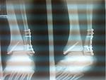 Click image for larger version

Name:	foot.JPG
Views:	13
Size:	26.8 KB
ID:	198369