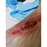 Click image for larger version

Name:	ouchy pic.jpg
Views:	92
Size:	23.5 KB
ID:	220464