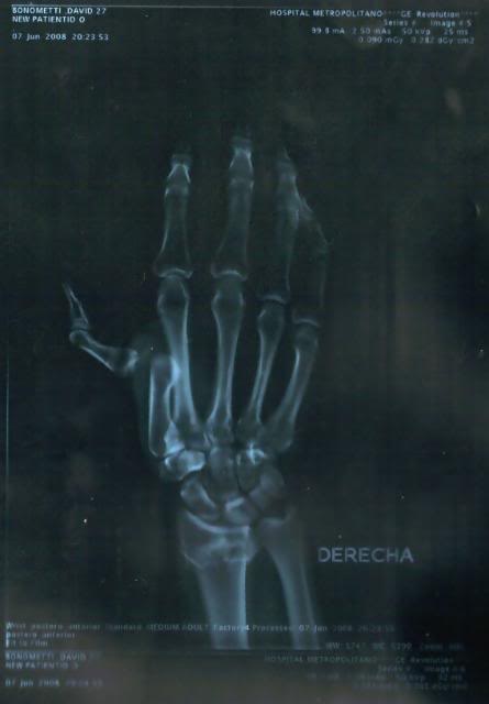 Name:  rightwrist1.jpg
Views: 18
Size:  17.7 KB