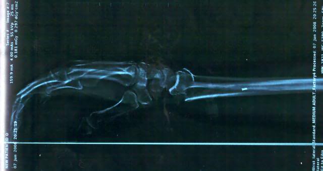 Name:  rightwrist2.jpg
Views: 18
Size:  20.7 KB