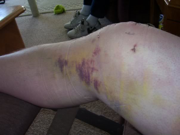 Name:  5371_133519075820_623205820_3627814.jpg
Views: 180
Size:  25.1 KB