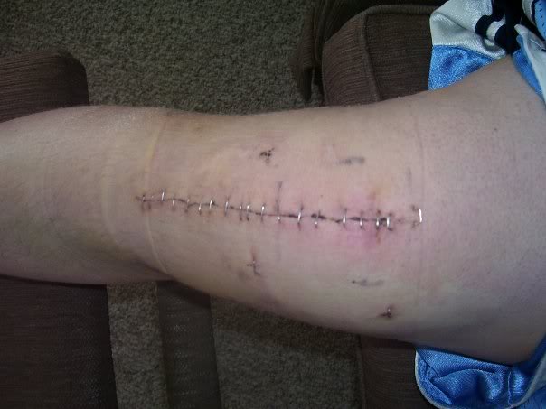 Name:  5371_133519080820_623205820_3627815.jpg
Views: 221
Size:  33.0 KB