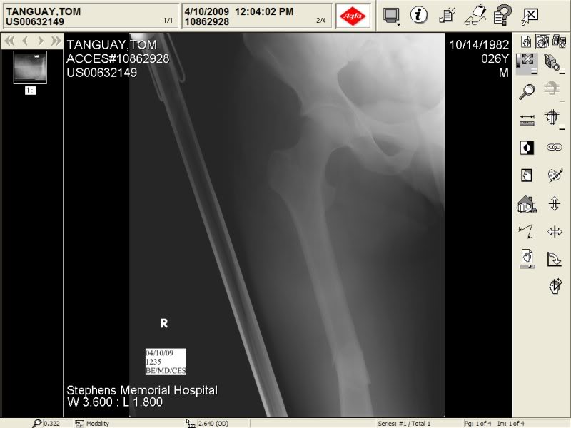 Name:  Cleanbreak1.jpg
Views: 8
Size:  47.5 KB