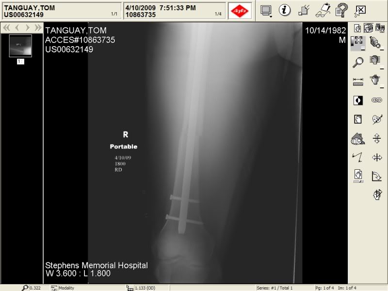 Name:  Pinsandrods.jpg
Views: 8
Size:  44.6 KB