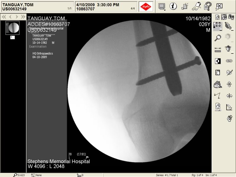 Name:  Screws.jpg
Views: 8
Size:  54.6 KB