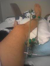 Name:  leg2.jpg
Views: 166
Size:  4.5 KB