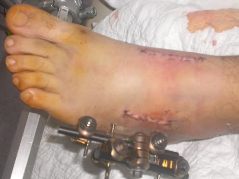 Name:  CIMG1328.jpg
Views: 289
Size:  61.0 KB