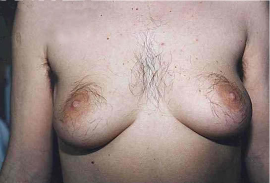 Name:  bearded-boob.jpg
Views: 7
Size:  32.3 KB