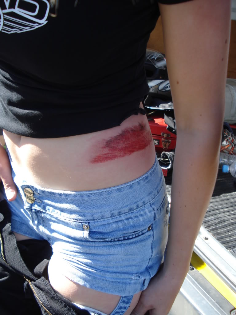 Name:  crashinjury.jpg
Views: 6
Size:  116.7 KB