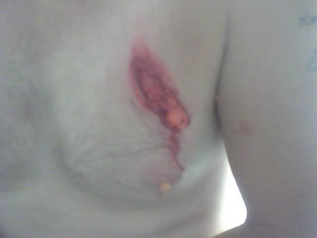 Name:  crash.jpg
Views: 10
Size:  11.8 KB