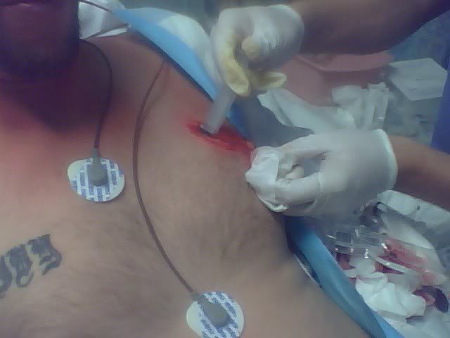 Name:  crash10.jpg
Views: 12
Size:  27.1 KB