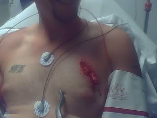 Name:  crash12bmp14.jpg
Views: 13
Size:  8.4 KB