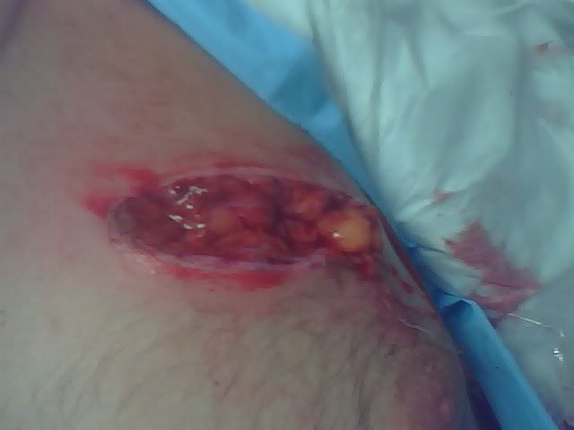 Name:  crash9-1.jpg
Views: 11
Size:  18.1 KB