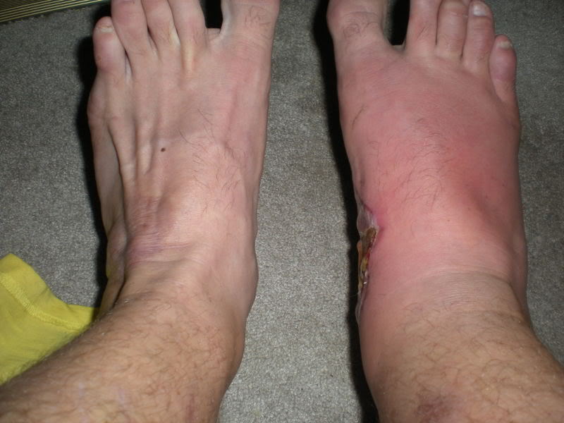 Name: footpics001.jpg
Views: 7
Size: 69.1 KB