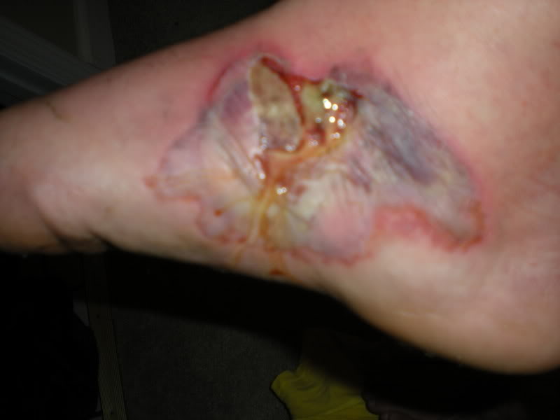 Name: footpics002.jpg
Views: 6
Size: 33.1 KB