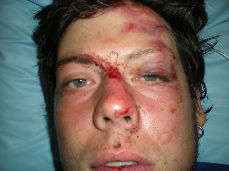 Name:  636wreck006.jpg
Views: 147
Size:  57.4 KB