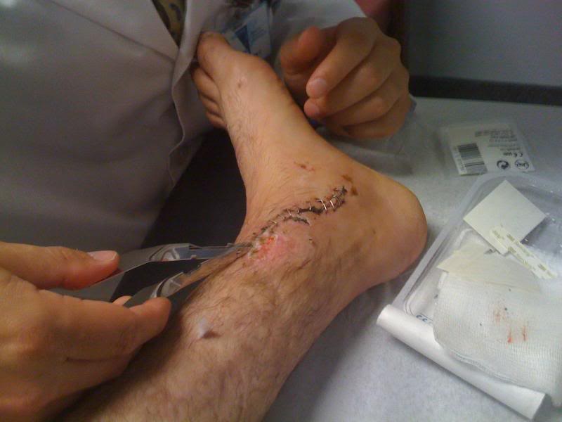 Name:  IMG_0052.jpg
Views: 11
Size:  37.9 KB