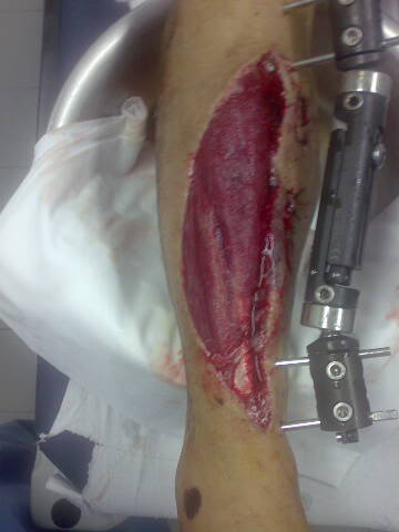 Name:  Fariasleg.jpg
Views: 13
Size:  17.6 KB