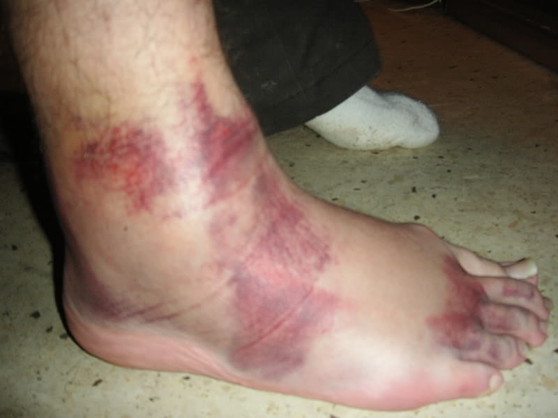 Name:  KIF_1847.jpg
Views: 4
Size:  44.9 KB