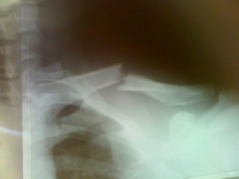Name:  Cphonepicts097.jpg
Views: 10
Size:  29.7 KB