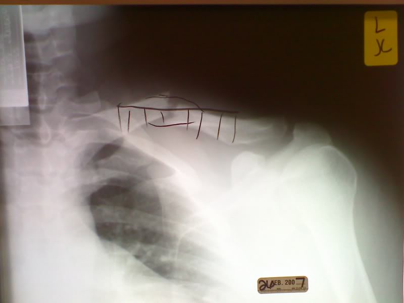 Name:  Cphonepicts098.jpg
Views: 14
Size:  33.9 KB