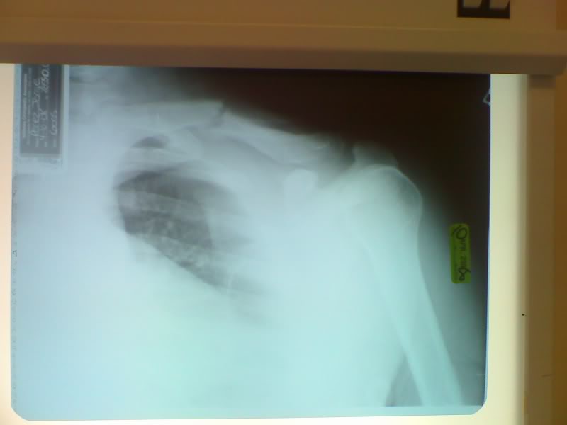 Name:  Cphonepicts126.jpg
Views: 22
Size:  29.5 KB