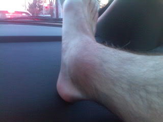 Name: VernBrokenLeg002.jpg
Views: 11
Size: 8.1 KB