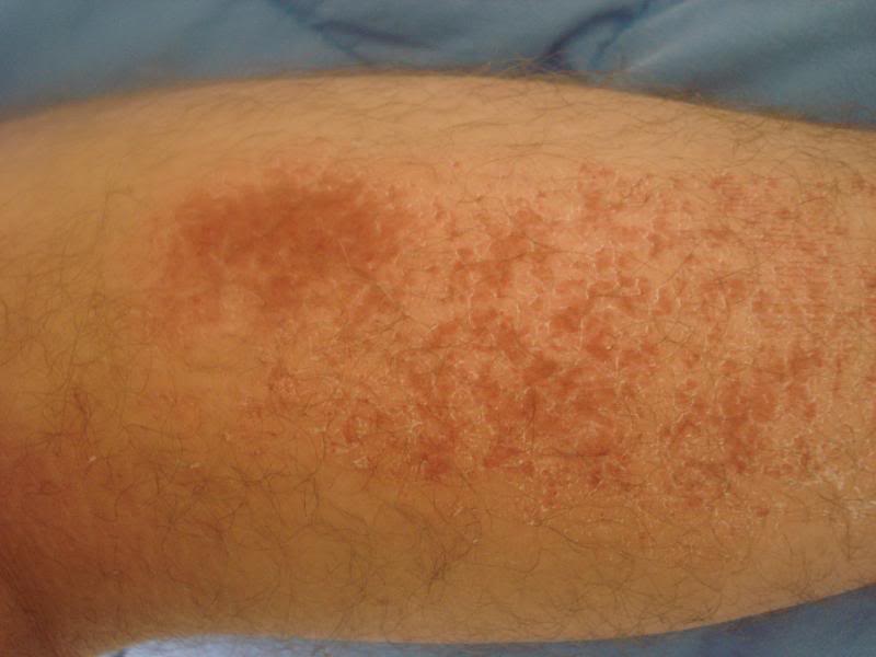 Name:  Picture048-2.jpg
Views: 7
Size:  41.1 KB