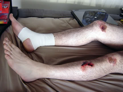 Name:  accident2smallcopy.jpg
Views: 7
Size:  27.3 KB