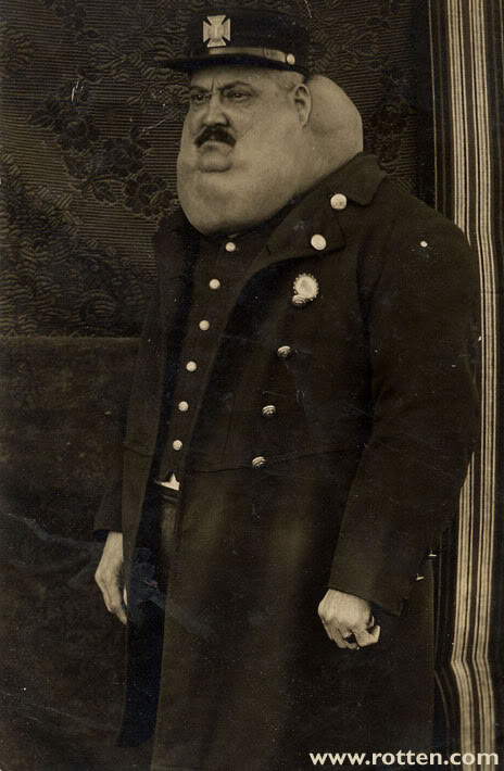 Name:  banjo-goiter-5.jpg
Views: 9
Size:  61.4 KB