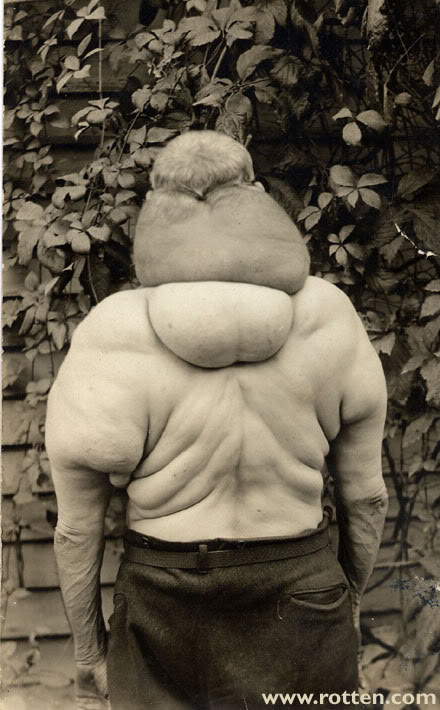 Name:  banjo-goiter-4.jpg
Views: 10
Size:  69.8 KB