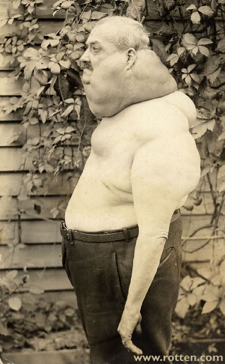 Name:  banjo-goiter-3.jpg
Views: 4
Size:  72.0 KB