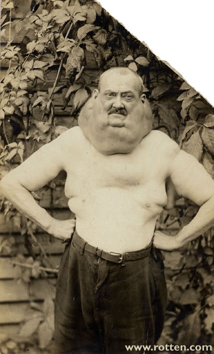 Name:  banjo-goiter-2.jpg
Views: 5
Size:  62.9 KB