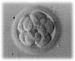 Click image for larger version

Name:	embryo.jpg
Views:	117
Size:	11.3 KB
ID:	47160
