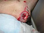Click image for larger version

Name:	martins foot.JPG
Views:	49
Size:	34.4 KB
ID:	83840