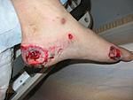 Click image for larger version

Name:	martins foot2.JPG
Views:	53
Size:	37.9 KB
ID:	83841